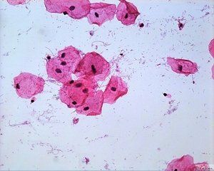 黑酒紅鏈黴菌 黑酒紅鏈黴菌