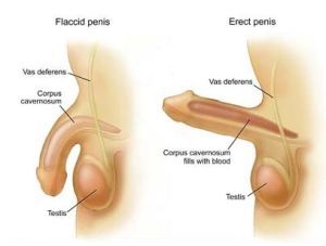 CF定位分離陰莖延長術 CF定位分離陰莖延長術