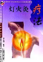 燈火灸療法 燈火灸療法