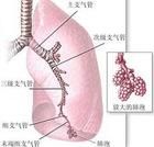 非小細胞肺癌
