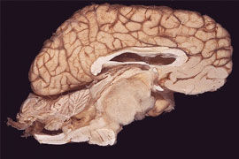 腦幹剖面圖