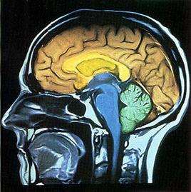 人類大腦十大未解之謎 人類大腦十大未解之謎