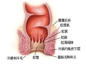 肛漏 肛漏