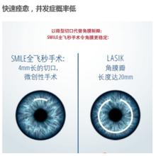 全飛秒雷射與飛秒雷射區別