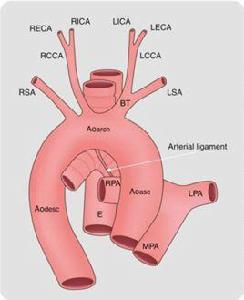 動脈圓錐 動脈圓錐