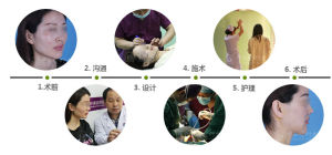 中山醫V-line顏面輪廓微雕