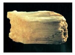 先天性脛骨假關節