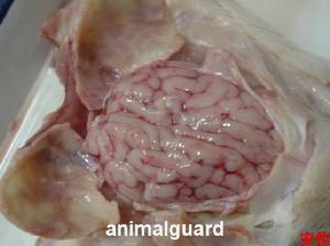 慢性硬腦膜下血腫 慢性硬腦膜下血腫