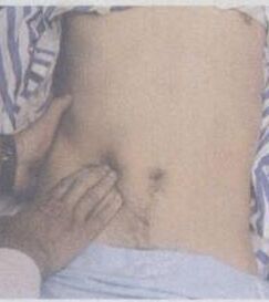 腹部觸診 腹部觸診