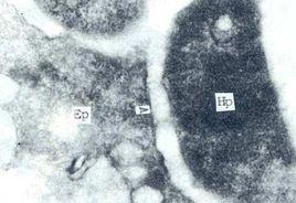 幽門螺旋桿菌相關性胃炎 幽門螺旋桿菌相關性胃炎