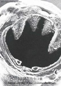 美洲板口線蟲 美洲板口線蟲