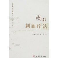 圖解刺血療法 圖解刺血療法