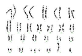 1號染色體 1號染色體