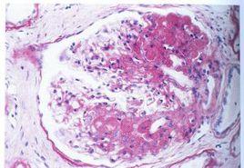 對氨馬尿酸鹽清除率 對氨馬尿酸鹽清除率