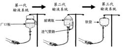 圖1 靜脈輸液方式的發展