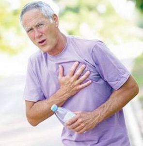 肋軟骨炎 肋軟骨炎