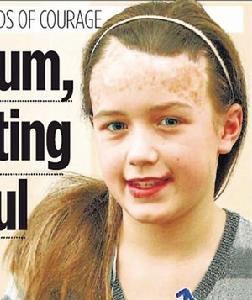 噴補皮膚 噴補皮膚