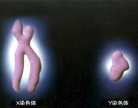 染色體異常遺傳病