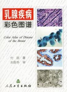 乳腺疾病彩色圖譜 乳腺疾病彩色圖譜