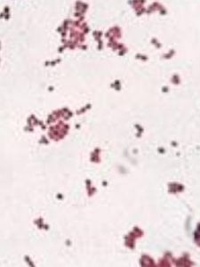 纖毛菌屬 纖毛菌屬