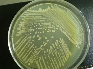 固態培養基發酵 固態培養基發酵