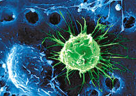 根達綜合症 根達綜合症