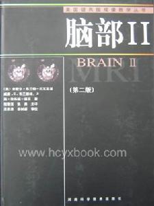 肌陣攣性小腦協調障礙