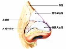 鼻骨骨折