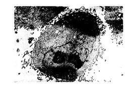 細胞衰老 細胞衰老