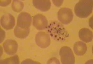 間日瘧原蟲 間日瘧原蟲