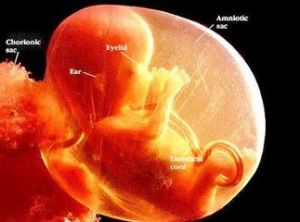 人造子宮 人造子宮