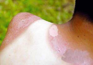 太陽的勳章[黃訓國演唱歌曲]