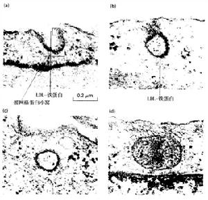 低密度的脂蛋白（LDL）經受體介導的內吞作用的起始階段的電鏡照片