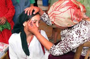 奧斯曼草(新疆姑娘的美麗秘方)