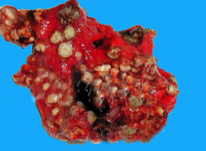 禽黴菌病 禽黴菌病