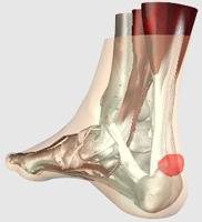 阿基里斯腱 阿基里斯腱