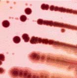 （圖）耶爾森氏菌病