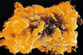 獲得性免疫缺陷綜合症的消化系統損害 獲得性免疫缺陷綜合症的消化系統損害