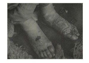 低溫損害 低溫損害