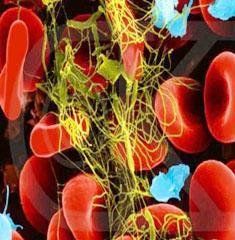 失血性貧血 失血性貧血