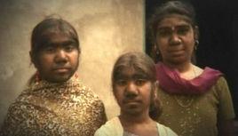 世界十大獸孩 世界十大獸孩