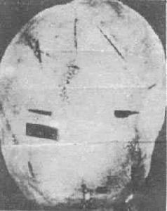 機械性損傷 機械性損傷