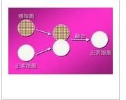 腫瘤抑制基因 腫瘤抑制基因