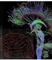 功能磁共振 功能磁共振