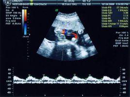 系統彩超 系統彩超