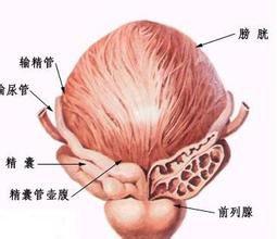 前列腺不育 前列腺不育