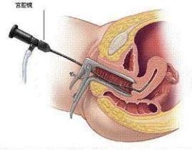 宮腹腔鏡 宮腹腔鏡