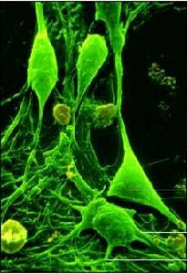 生命細胞轉移 生命細胞轉移