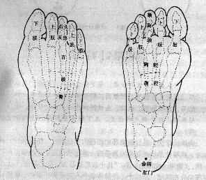 足象針 足象針