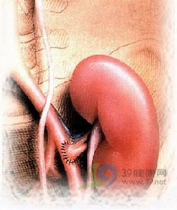 腎動脈血栓形成和栓塞